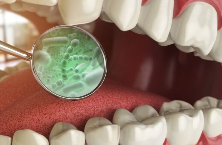 Mouth Bacteria Predict Heart Attacks